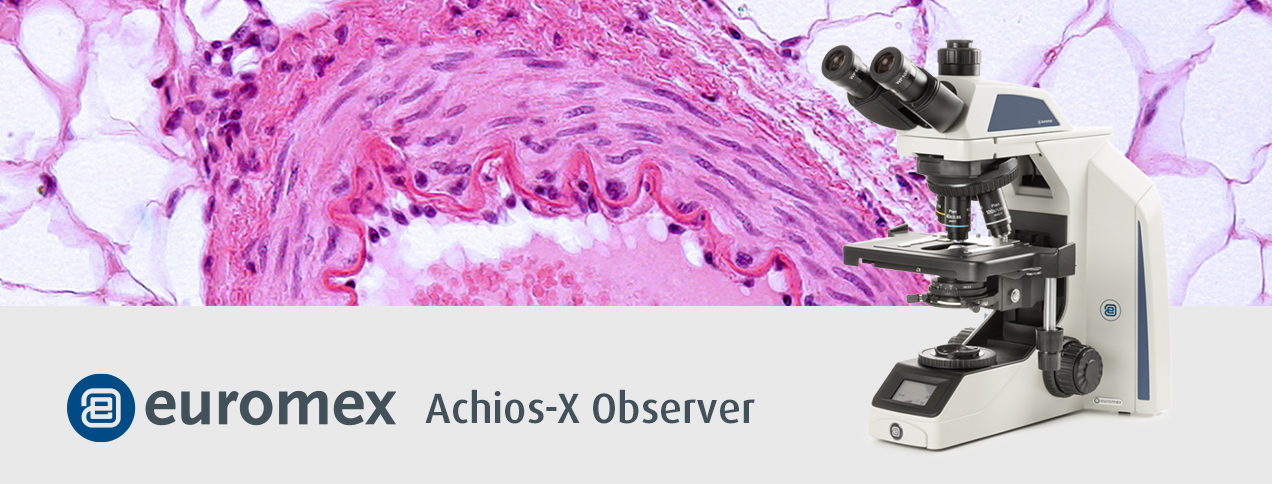 Achios-X Oberserver