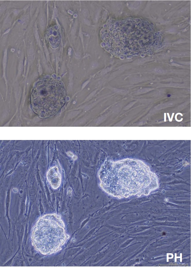 Inversionskontrast (IVC)