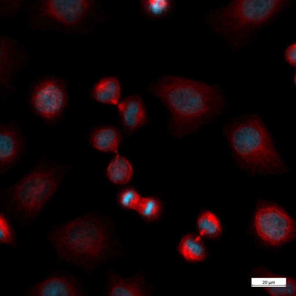 Zeiss Axiovert5 Fluoreszenz