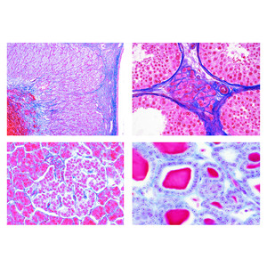 LIEDER Sekundarstufe, Set IV Hormone und Hormonfunktion (7 Präp)