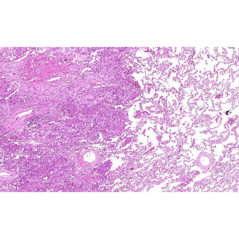 Lumenera Kamera INFINITY2-2C, CCD, color, 2.0 MP