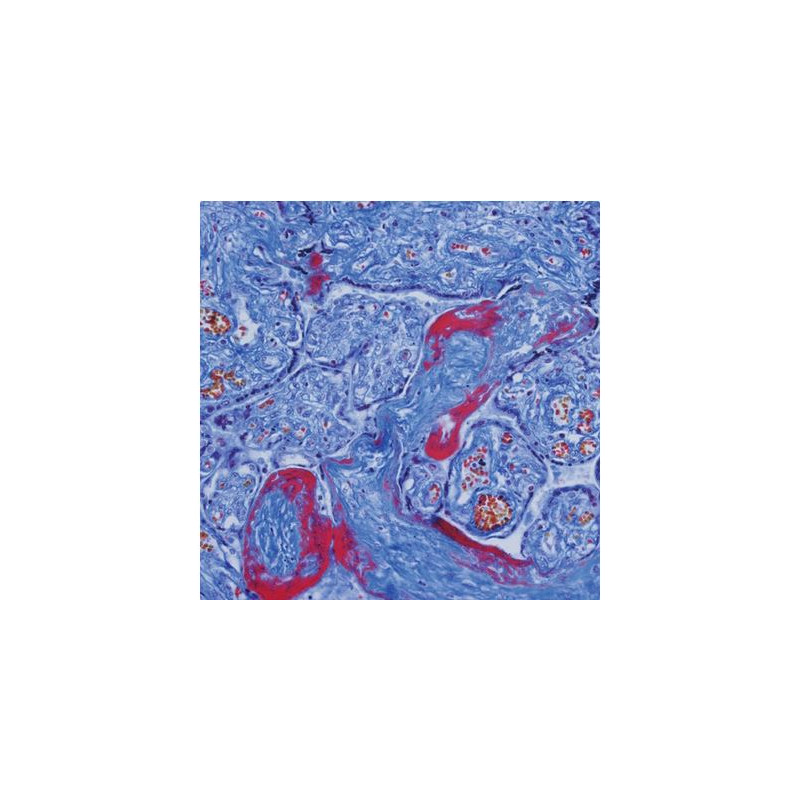 Evident Olympus Mikroskop CX41 Hämatologie, trino, Hal, 40x, 500x, 1000x